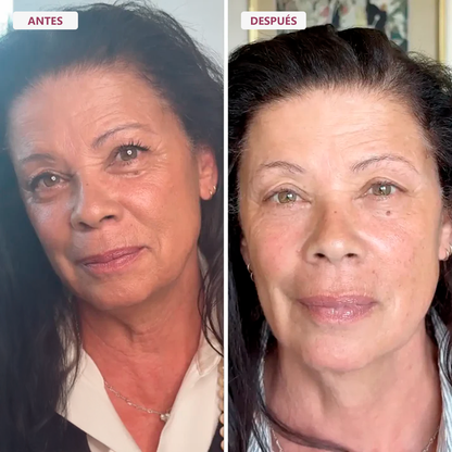 RE-ESTRUCTURA 45+® | El Rescate De La Firmeza Facial