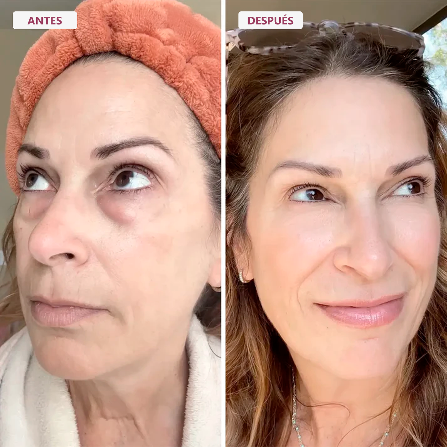 RE-ESTRUCTURA 45+® | El Rescate De La Firmeza Facial