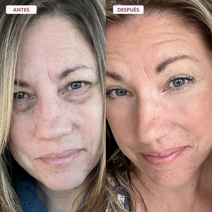 RE-ESTRUCTURA 45+® | El Rescate De La Firmeza Facial