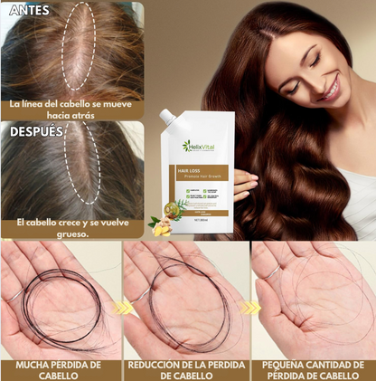 HELIXVITAL | RECUPERA EL CABELLO QUE CREÍAS PERDIDO EN SÓLO 20 DÍAS. 🚀