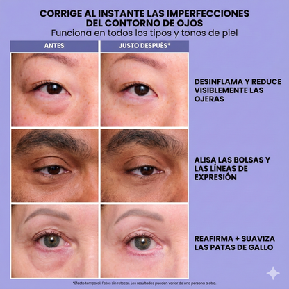 LIFTINSTANT™ | EL BORRADOR DE BOLSAS Y ARRUGAS EN 60 SEGUNDOS 👁️