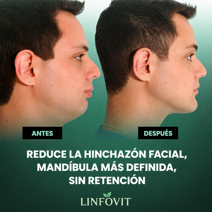 Linfovit™ | Drenaje Linfático Para Hombres 🍻 Hoy Oferta Especial 1+1 🎁