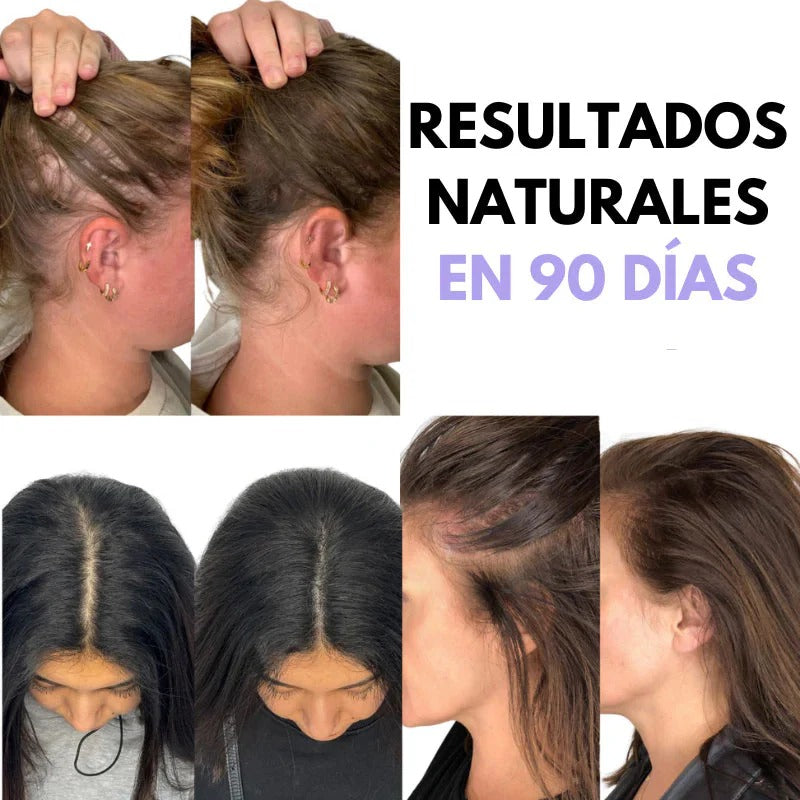 HairBloom™ | Donde Tu Cabello Vuelve a Florecer 🌸