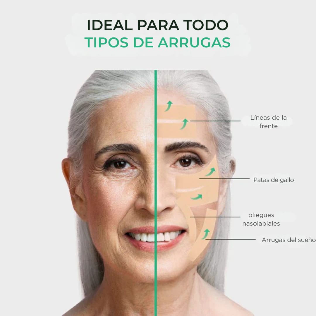 Cicatrix Vanish™ | Elimina Marcas De Acné, Cirugías y Quemaduras En 4 Semanas…!