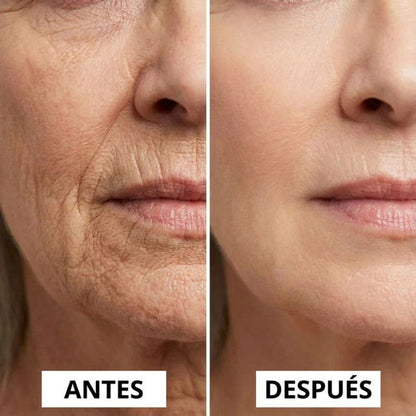 RE-ESTRUCTURA 45+® | El Rescate De La Firmeza Facial