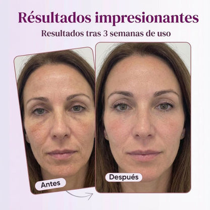RE-ESTRUCTURA 45+® | El Rescate De La Firmeza Facial